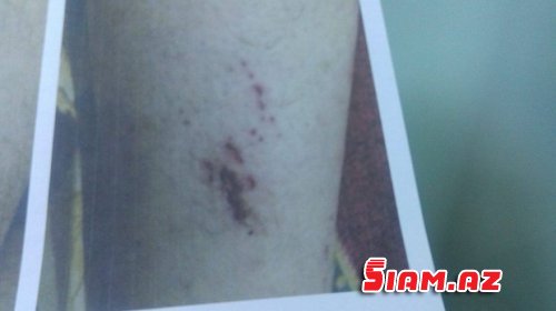Rəis 38 ilin neftçisini döyüb işdən qovdu Rəis 38 ilin neftçisini döyüb işdən qovdu